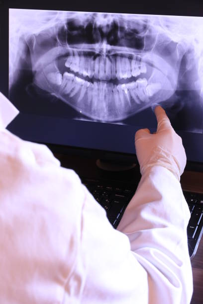 Best Emergency Root Canal Therapy in Fennville, MI