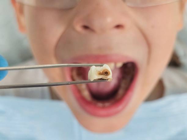 Best Emergency Treatment for Jaw Pain or Injury in Fennville, MI