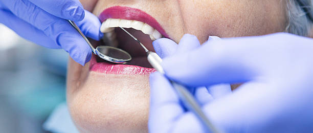 Best Broken or Chipped Tooth Repair in Fennville, MI